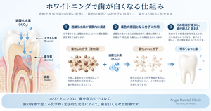 ホワイトニングの仕組みを説明した図